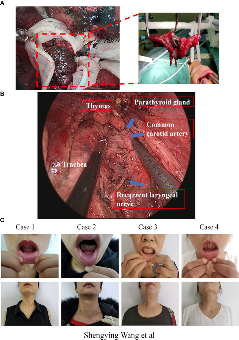 Figure 2