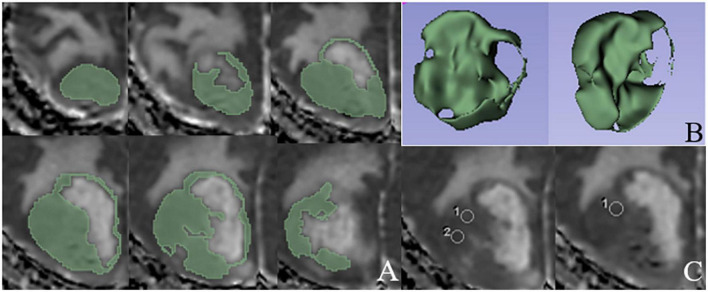 FIGURE 2