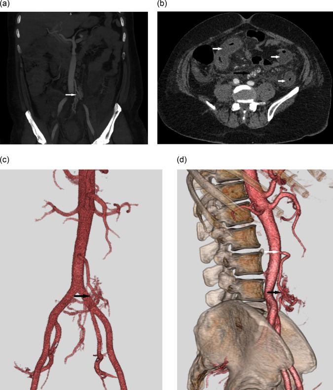 Figure 1