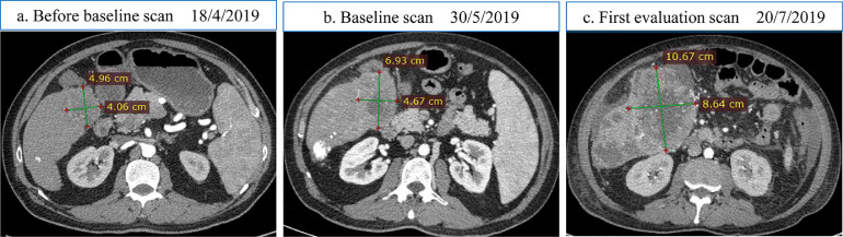 Fig 2