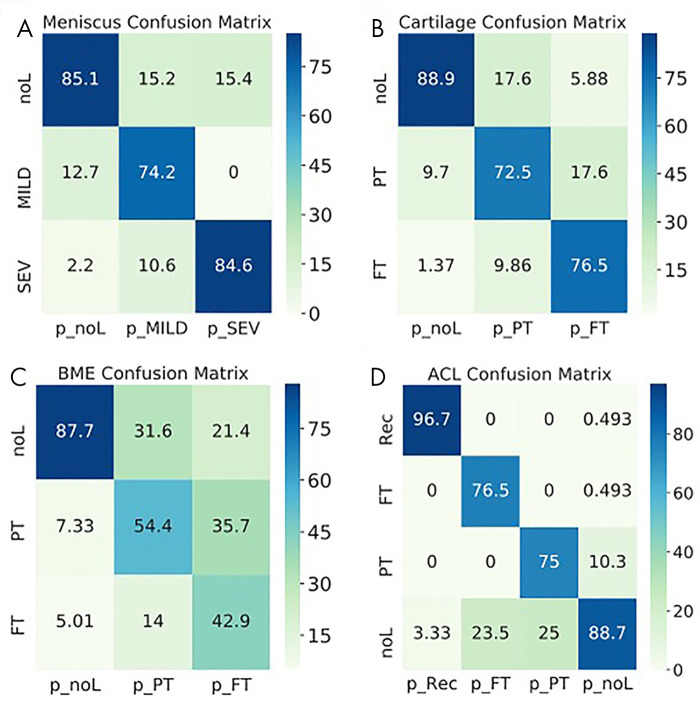 Normalized confusion matrices show the accuracy of the three-dimensional convolutional network predictions for, A, meniscus, B, cartilage, C, bone marrow edema (BME) and, D, anterior cruciate ligament (ACL). Each column shows the prediction (p_), and each row shows the ground truth. FT = full-thickness lesions, MILD = mild lesions, noL = no lesions, PT = partial-thickness lesions, Rec = reconstructed, SEV = severe lesions.