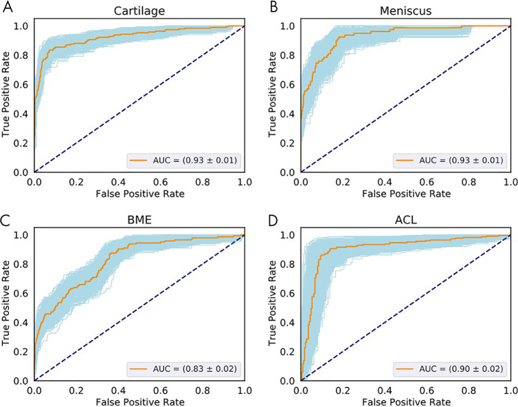 Receiver operating characteristic (ROC) curves show the diagnostic performance of cartilage, meniscus, and bone marrow edema (BME) lesion detection in the full-knee lesion-assessment proposal. Orange lines represent the average ROC curves. Blue shaded areas represent the ROC curves with areas under the ROC curve (AUCs) within 1 standard deviation of the mean after bootstrapping 1000 times. Dashed diagonal lines represent an AUC equal to 0.5. ROC curves and AUCs are shown for the detection of lesions within, A, cartilage, B, meniscus, C, BME and for D, anterior cruciate ligament (ACL).