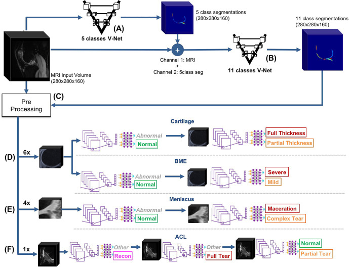 Overview of the fully automated deep learning pipeline. A, An automatic, five-class cartilage-compartment segmentation was trained through a V-Net neural network architecture on manually segmented images and then applied to the entire dataset. B, The original image and its five class segmentations (5class seg) were used as input (first and second channels, respectively) into another V-Net responsible for labeling the segmentations according to 11 classes. C, Preprocessing pipeline where the data were split into training (70%), validation (15%), and holdout test (15%) datasets. Equal lesion-class distributions for each compartment were maintained across splits. Volumetric bounding boxes around all of the cartilage-compartment segmentations were created and then used to extract regions of interest. As a result of the preprocessing pipeline, volumes and Whole-Organ MRI Score grading of cartilage compartments were stored and ready to be used for training and/or inference. D–F, The resulting volumes and their respective grades were used as inputs and labels, respectively, to train 17 three-dimensional convolutional neural network deep learning classifiers, which assessed the presence and/or severity of, D, cartilage and bone marrow edema (BME) lesions, E, meniscus lesions, and, F, anterior cruciate ligament (ACL) lesions. In total, 52 probabilities were computed and output by the pipeline. Colors in the output of the models indicate the class. Green indicates the normal class, yellow indicates a mild or moderate lesion, red indicates a severe lesion, and pink indicates reconstruction (specific to the ACL).