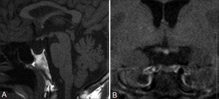 Figure 4 (A, B)