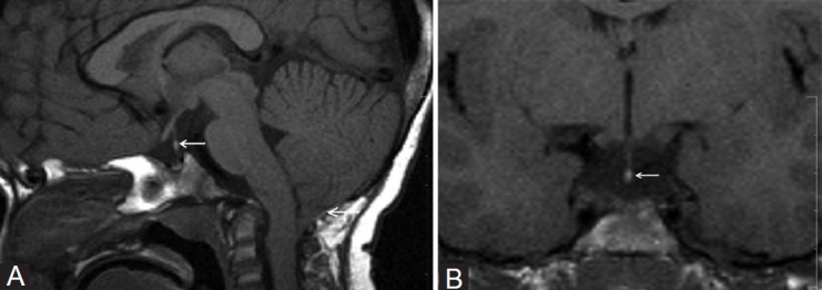 Figure 1 (A, B)