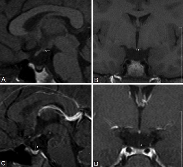 Figure 2 (A-D)