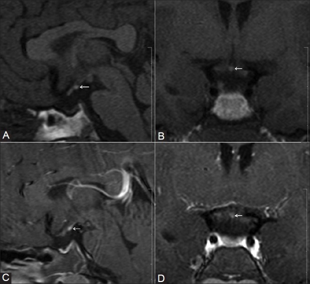 Figure 3 (A-D)