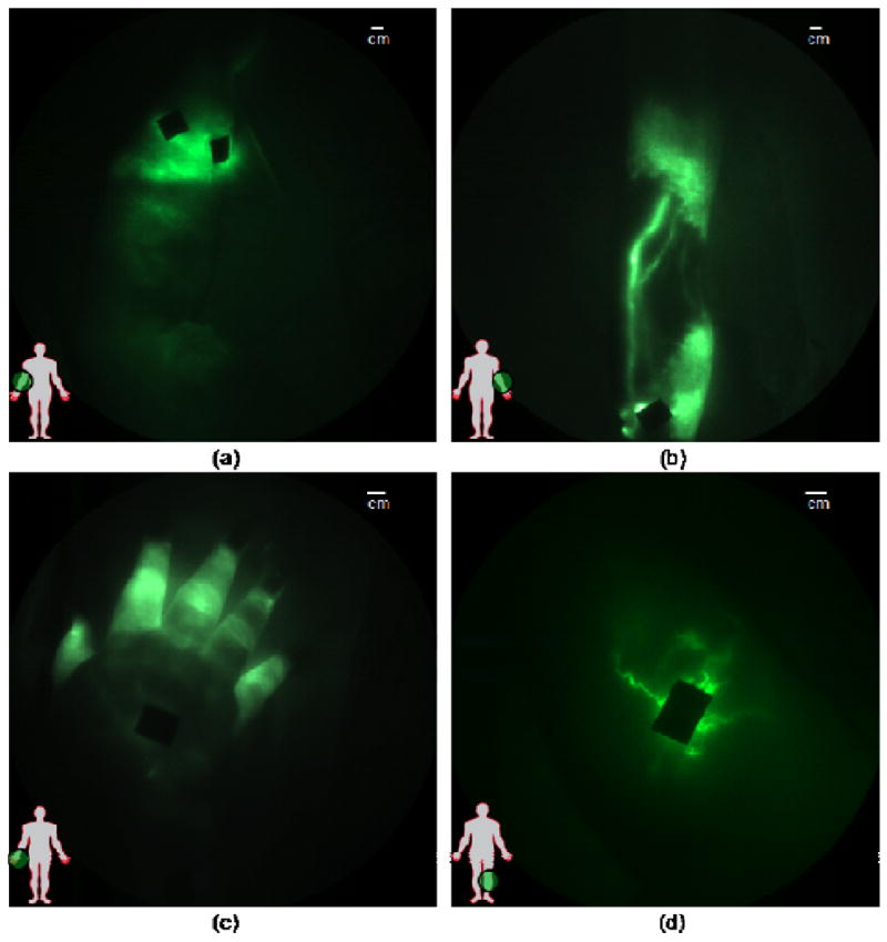 Fig. (4)