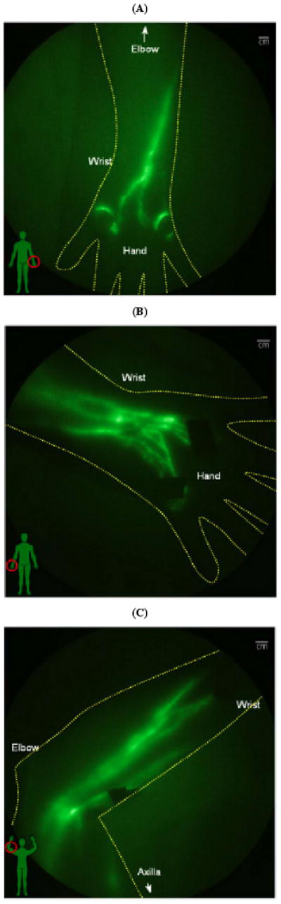 Fig. (2)