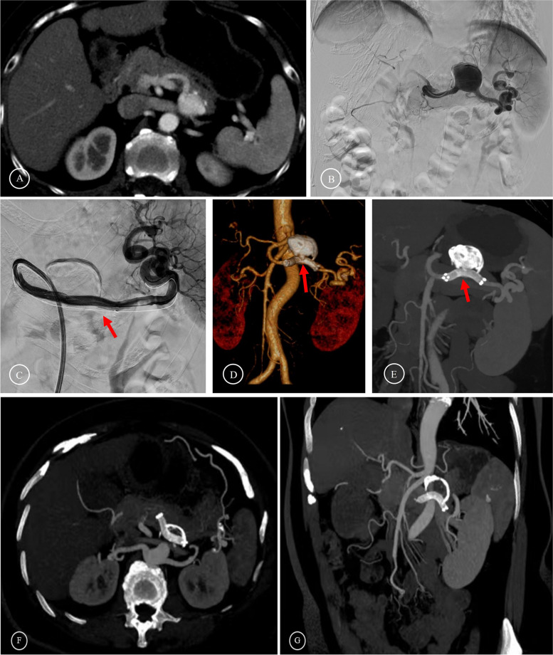 Fig. 4