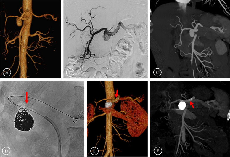 Fig. 3