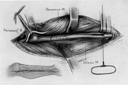 Fig. 2A.