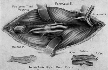 Fig. 1B.