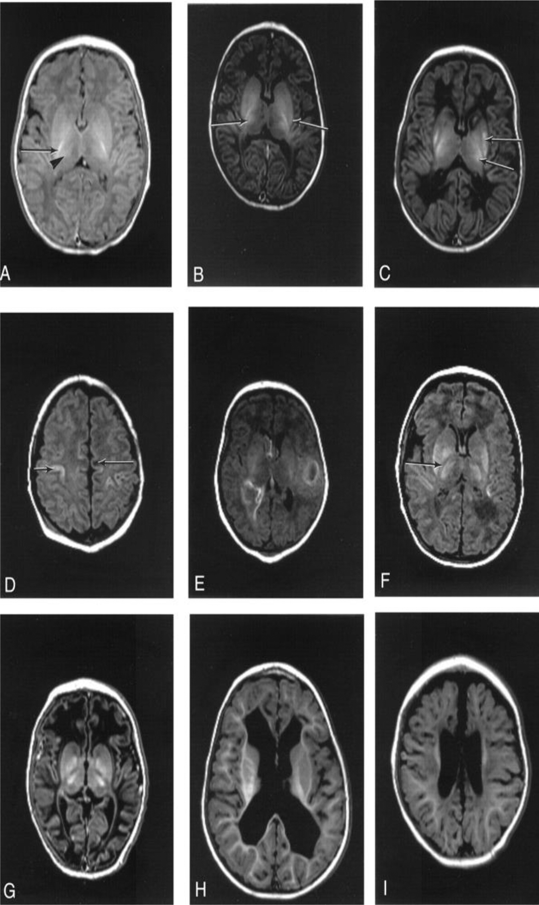 Fig. 11.