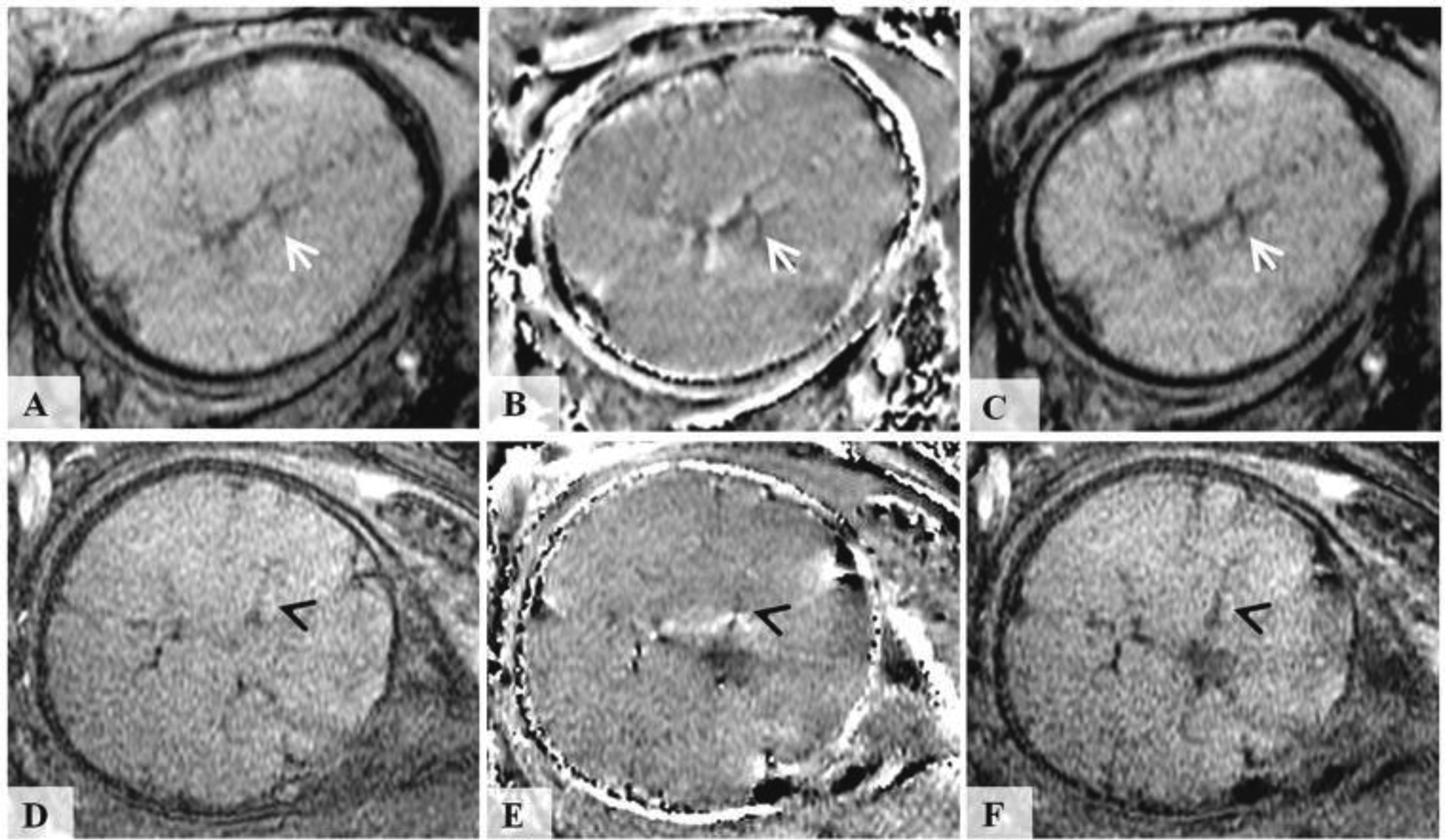 Fig. 10.