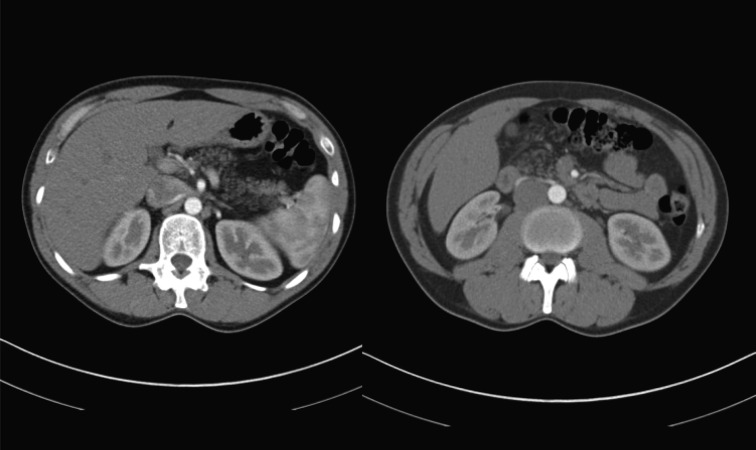 Fig. 2.