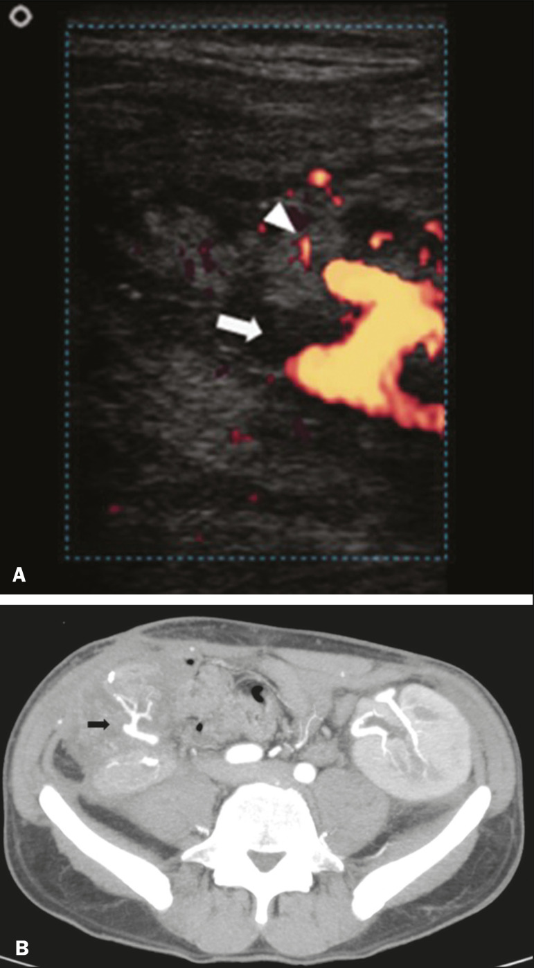 Figure 10