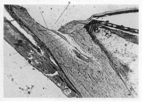 Fig. 53.