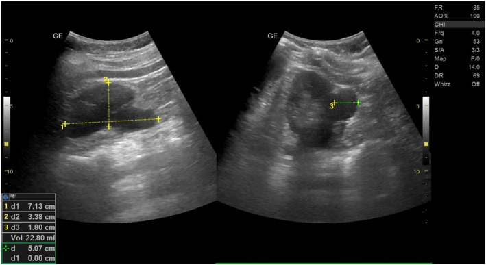 FIGURE 1