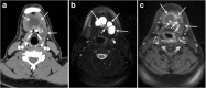 Fig. 21