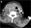 Fig. 12
