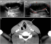 Fig. 19