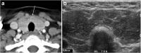 Fig. 15