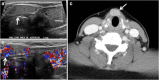 Fig. 16