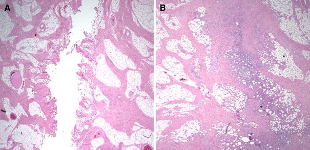 Fig. 6