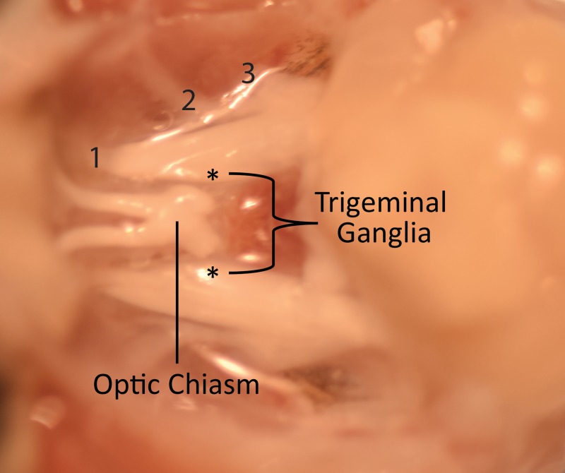 Fig 2