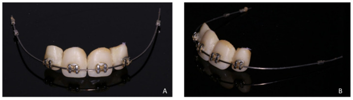 Figure 15