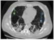 Figure 12.