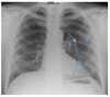 Figure 7.