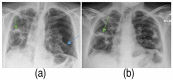 Figure 11.