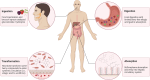 Figure 1. Bioprocessing of select green cancer prevention food components. Created with BioRender.com. Legend, Human bioprocessing of select bioactive components in green cancer prevention. Ingestion, Food mastication reduces berries and broccoli sprouts to smaller food particles. Mastication of broccoli sprout cell walls releases its myrosinase catalyzing glucosinolate hydrolysis for sulforaphane release. Digestion, Masticated berry food particles release small amounts of free ellagic acid for limited gastric absorption. More complex berry ellagitannins are also released and undergo further digestion to ellagic acid. Masticated broccoli sprouts food particles enter the gastric compartment for continued sulforaphane processing and release. Gastric enzymes mix with both berry and broccoli sprout food particles forming chyme entering the small intestine. Absorption, Digested berry-derived food particles undergo limited absorption in the small intestine and move into the large intestine for further microbial bioprocessing. Sulforaphane, a major broccoli sprout glucosinolate, is primarily absorbed in the small intestine entering hepatic circulation for systemic distribution. Transformation, Berry-derived ellagic acid enters the large colon where resident microbiota metabolizes ellagic acid to urolithins for colonocyte absorption and transport into the systemic circulation. Little, if any, sulforaphane enters the colonic lumen as it was largely absorbed in the small intestine.