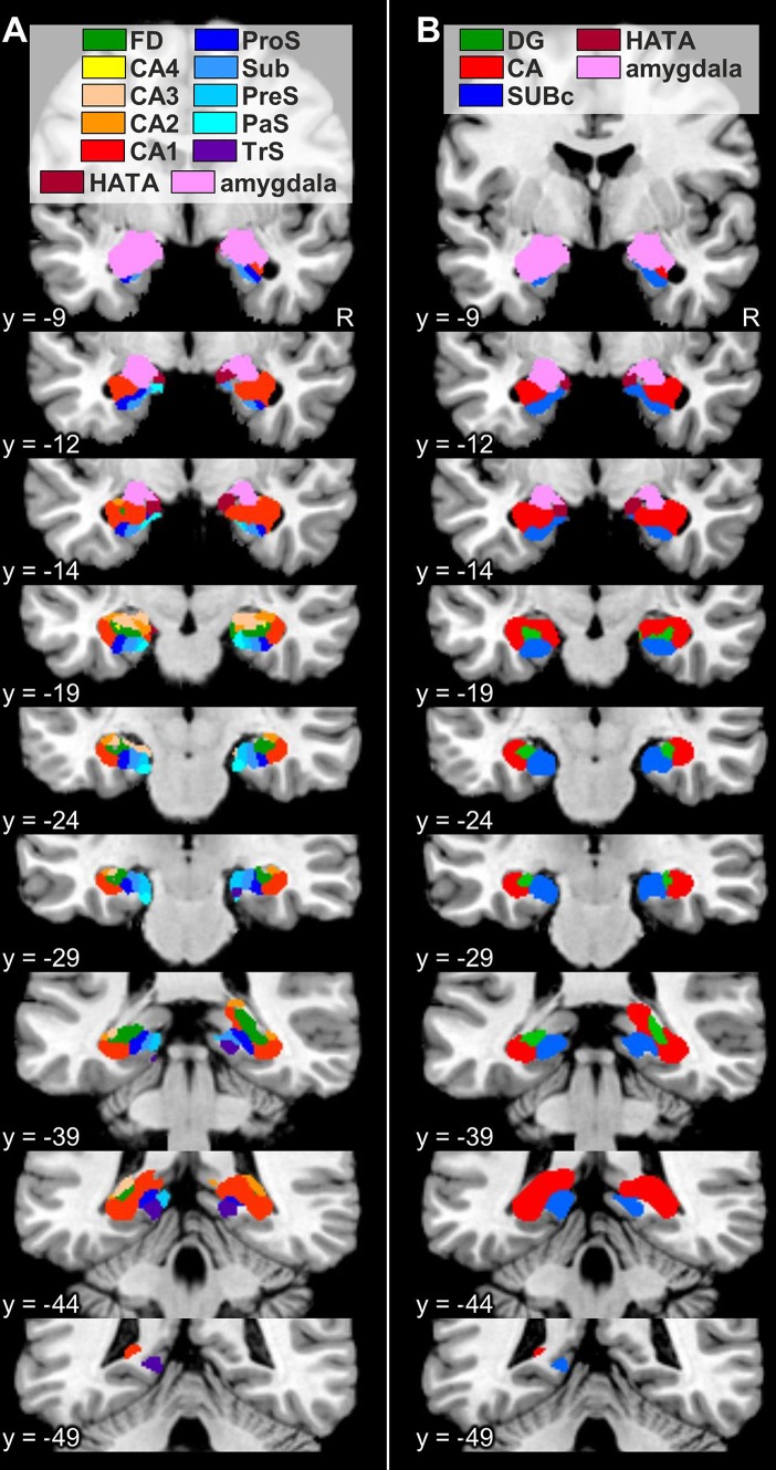 Fig. 12