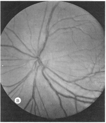 FIGURE 17 B