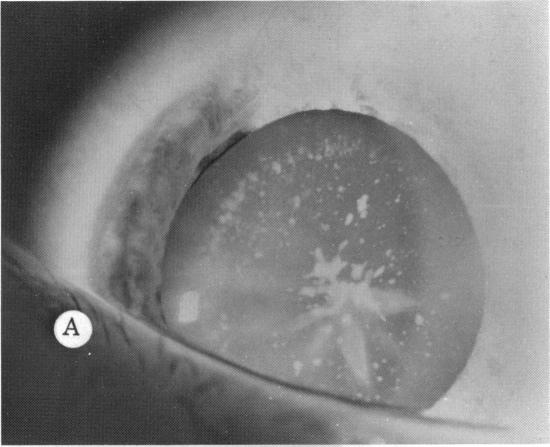 FIGURE 14 A