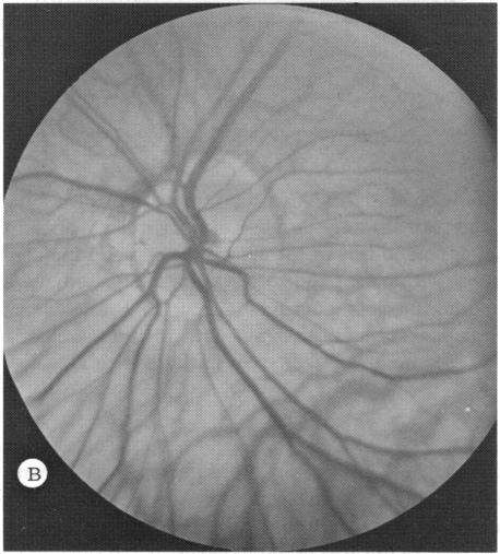 FIGURE 19 B