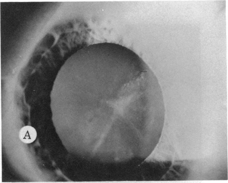 FIGURE 15 A