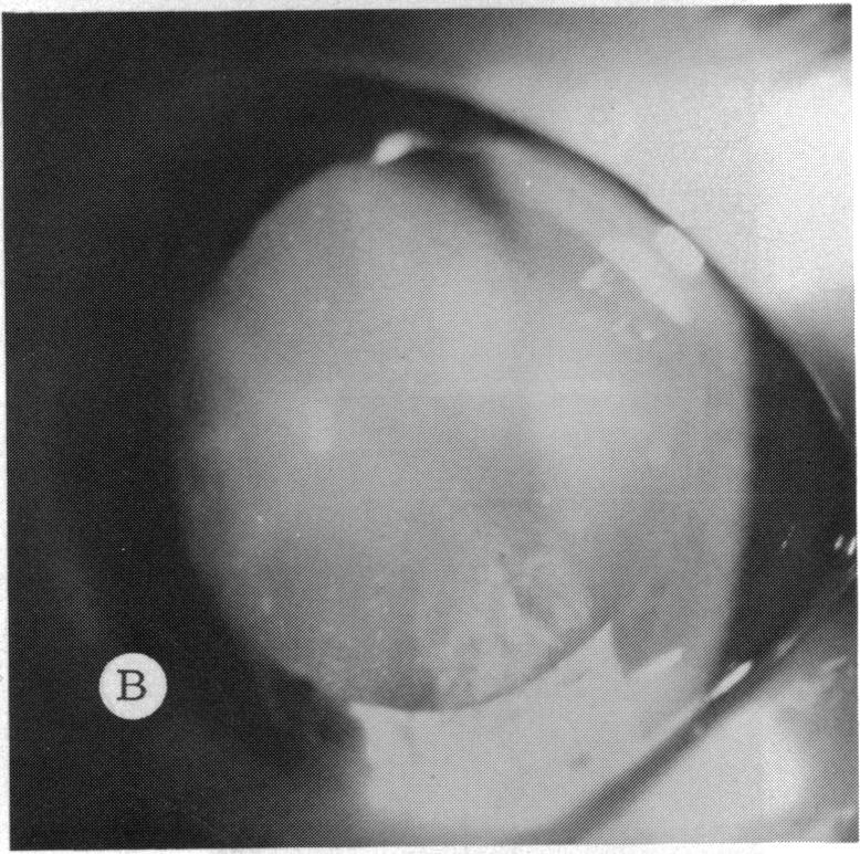 FIGURE 15 B