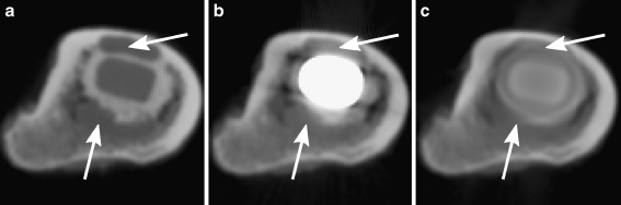 Fig. 11