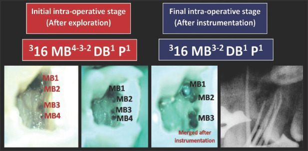 Figure 16