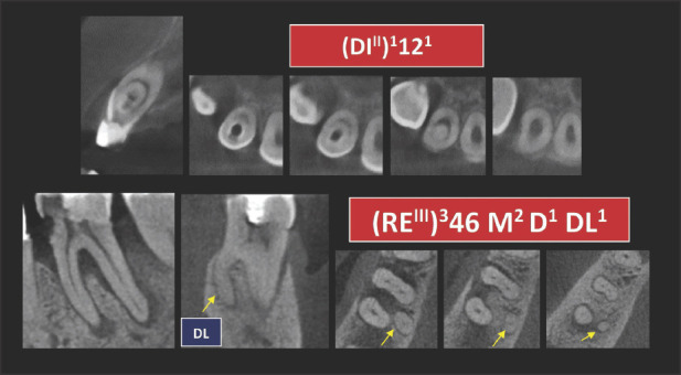 Figure 12