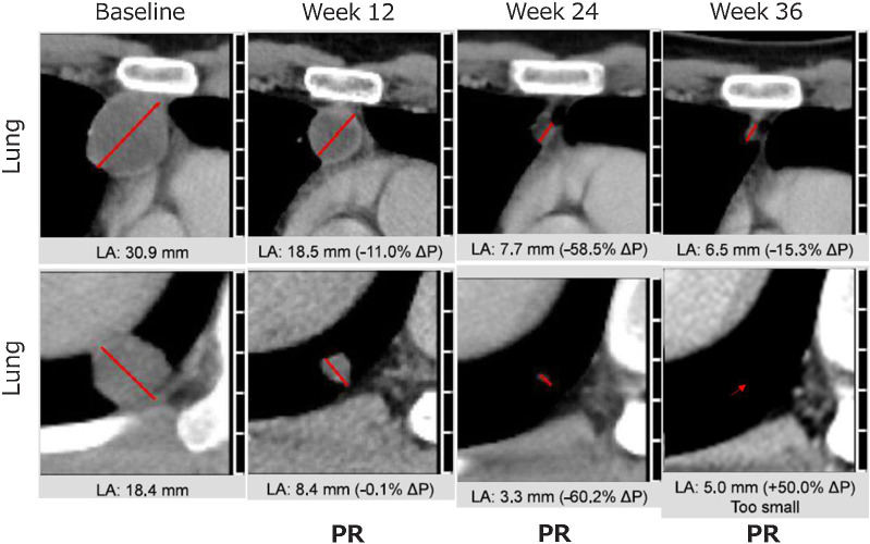 Figure 3. Representative CT scan images in one patient (TBI1301–03–02).