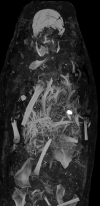 Fig 11