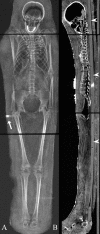Fig 13