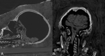 Fig 15