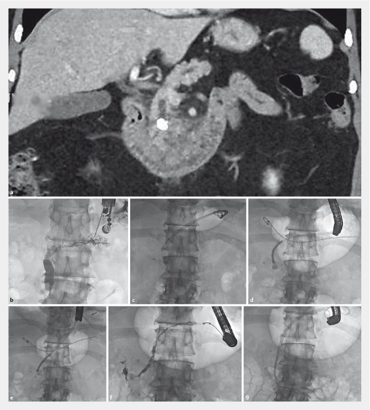 Fig. 1 a