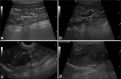 Figure-2